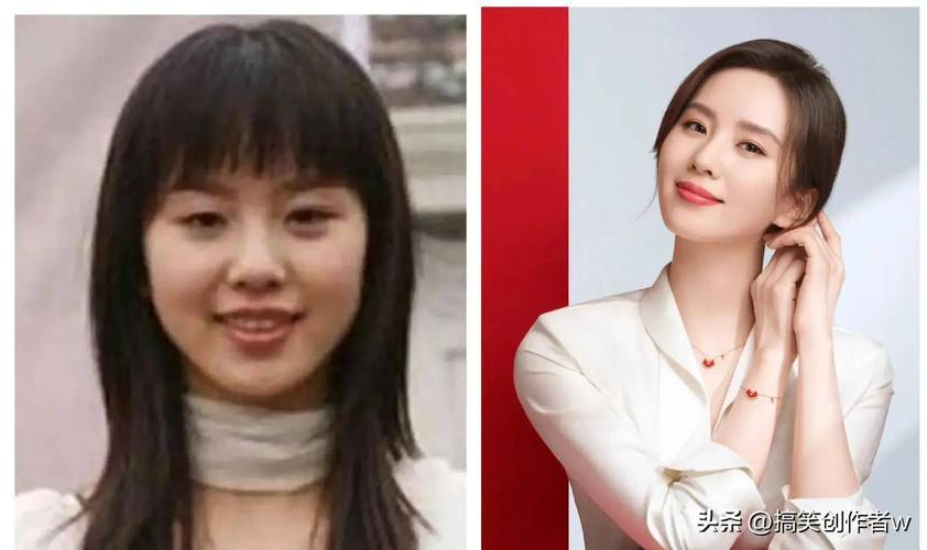 杨紫整容争议引热议,演技与颜值之争再起风云 杨紫整容争议引热议,演技与颜值之争再起风云